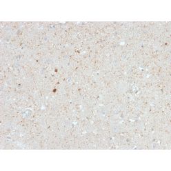 Calretinin / Calbindin 2 (Mesothelioma Marker)(CALB2/2603), CF740 conjugate, 0.1mg/mL
