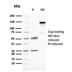 BAP1 (BRCA1 Associated Protein 1)(BAP1/2667), CF740 conjugate, 0.1mg/mL