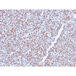 ALK (Anaplastic Lymphoma Kinase) / CD246(ALK1/2766R), CF740 conjugate, 0.1mg/mL