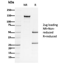 APC / Adenomatous Polyposis Coli / FAP (Tumor Suppressor)(ALi 12-28), CF740 conjugate, 0.1mg/mL
