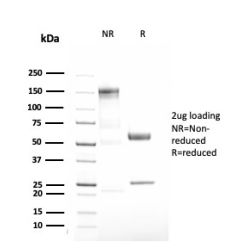 Alpha-1-Antitrypsin (SERPINA1) (Hepatocellular & Histiocytic Marker)(AAT/3167R), CF740 conjugate, 0.1mg/mL