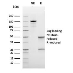 Bcl-6 (Follicular Lymphoma Marker)(rBCL6/1475), CF740 conjugate, 0.1mg/mL