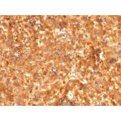 AFP (Alpha Fetoprotein)(C2 + C3 + MBS-12), CF488A conjugate, 0.1mg/mL