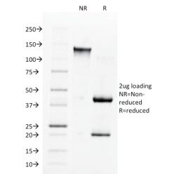 Biotium BNC881560-500, Angiotensin I Converting Enzyme (ACE) / CD143(9B9), CF488A conjugate, 0.1mg/mL