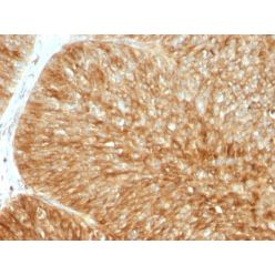 Biotium BNC881857-500, Beta-2 Microglobulin (Renal Failure & Tumor Marker) (B2M/1857R), CF488A conjugate, 0.1mg/mL