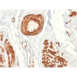 Biotium BNC881897-500, Caldesmon, HMW (h-Caldesmon) (Smooth Muscle Marker) (rCALD1/820), CF488A conjugate, 0.1mg/mL
