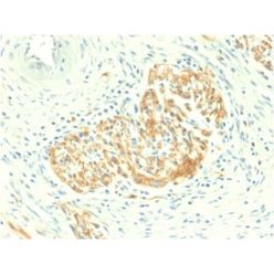 CD56 / NCAM1 / NKH1 (Neuronal Cell Marker) (NCAM1/2217R), CF488A conjugate, 0.1mg/mL