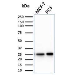 Biotium BNC882266-500, Calcineurin B homologous protein 2 / HCC Antigen 520(CPTC-CHP2-1), CF488A conjugate, 0.1mg/mL