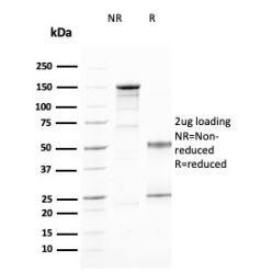 Biotium BNC882394-500, CD25 / IL2RA (Activated Lymphocyte Marker)(IL2RA/2394), CF488A conjugate, 0.1mg/mL