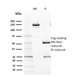 Biotium BNC882670-500, CD117 / c-Kit (Marker for Gastrointestinal Stromal Tumors)(KIT/2670), CF488A conjugate, 0.1mg/mL
