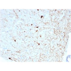 Biotium BNC882786-500, Calretinin / Calbindin 2 (Mesothelioma Marker)(CALB2/2786), CF488A conjugate, 0.1mg/mL