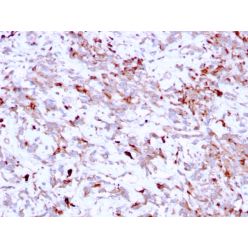 Biotium BNC882791-500, Cathepsin K (Marker of Tumor Invasiveness)(CTSK/2791), CF488A conjugate, 0.1mg/mL