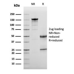 Complement 3d (C3d) (Acute Humoral Rejection Marker)(C3D/2891), CF488A conjugate, 0.1mg/mL