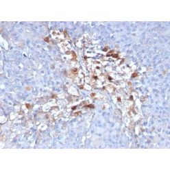 CD146 / MCAM / MUC18 / Mucin 18(C146/634), CF594 conjugate, 0.1mg/mL