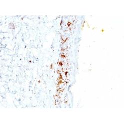 CD1a(C1A/711), CF594 conjugate, 0.1mg/mL