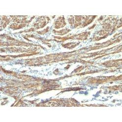 Caldesmon, HMW (h-Caldesmon)(CALD1/820 + h-CALD), CF594 conjugate, 0.1mg/mL