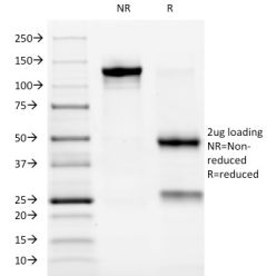 Biotium BNC941032-100, ALK (Anaplastic Lymphoma Kinase) / CD246(ALK/1032), CF594 conjugate, 0.1mg/mL