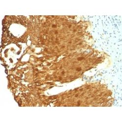 Cytokeratin 19(KRT19/799 + KRT19/800), CF594 conjugate, 0.1mg/mL