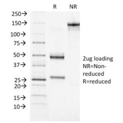 BRCA1 (Breast Marker) (BRCA1/1472), CF594 conjugate, 0.1mg/mL