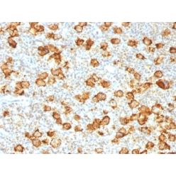 CD30 / TNFRSF8 (Hodgkin &amp; Reed-Sternberg Cell Marker) (Ki-1/1505R), CF594 conjugate, 0.1mg/mL