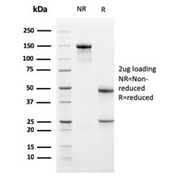 Biotium BNC941762-500, Bcl-X (Apoptosis Marker)(BCL2L1/1762), CF594 conjugate, 0.1mg/mL