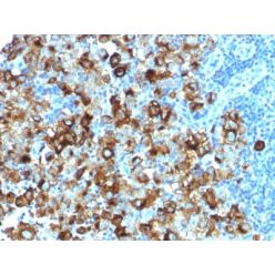 gp100 / Melanosome / PMEL17 / SILV (Melanoma Marker) (PMEL/1825R), CF594 conjugate, 0.1mg/mL