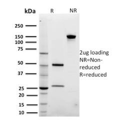 Biotium BNC942029-500, ARF1 (Golgi Apparatus Marker)(3F1), CF594 conjugate, 0.1mg/mL