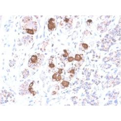 Biotium BNC942040-500, ACTH (Adrenocorticotrophic Hormone) (Pituitary Marker) (CLIP/2040R), CF594 conjugate, 0.1mg/mL