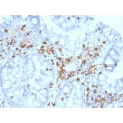 Biotium BNC942063-500, CD103 / Integrin alpha E (T-Cell Lymphoma & Hairy Cell Leukemia Marker) (ITGAE/2063), CF594 conjugate, 0.1mg/mL