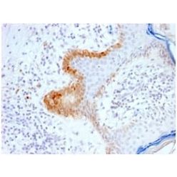 Cytokeratin 15 (Esophageal Squamous Cell Carcinoma Marker) (KRT15/2103R), CF594 conjugate, 0.1mg/mL