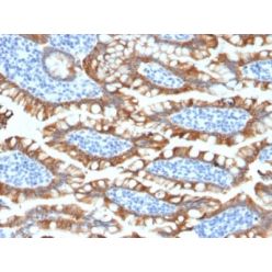 Cytokeratin 8 (KRT8) (KRT8/2174R), CF594 conjugate, 0.1mg/mL