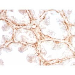 Galectin-1 / Human Placental Lactogen (hPL) (GAL1/2499R), CF594 conjugate, 0.1mg/mL
