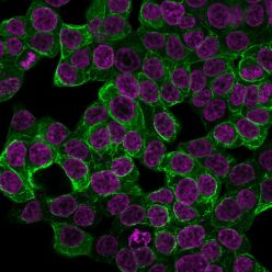 Cytokeratin 18 (KRT18) (KRT18/2808R), CF594 conjugate, 0.1mg/mL