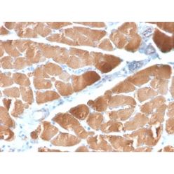 Desmin (Muscle Cell Marker) (DES/2960R), CF594 conjugate, 0.1mg/mL