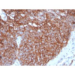 GLUT-1 (Tumor Progression and Mesothelioma Marker)(GLUT1/3132R), CF594 conjugate, 0.1mg/mL