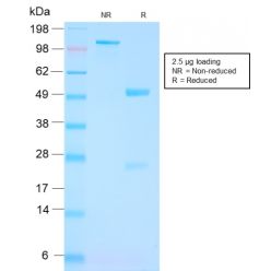 FOLH1 / PSMA (Prostate Epithelial Marker)(FOLH1/3149R), CF594 conjugate, 0.1mg/mL
