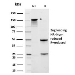 Cytokeratin 6A (KRT6A) (Basal Cell Marker)(rKRT6A/2100), CF594 conjugate, 0.1mg/mL