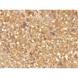 AFP (Alpha Fetoprotein)(MBS-12), Biotin conjugate, 0.1mg/mL