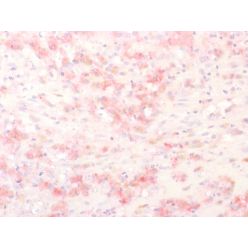 Tyrosinase-Related Protein-1 (TYRP-1) (Melanoma Marker), Biotin conjugate, 0.1mg/mL