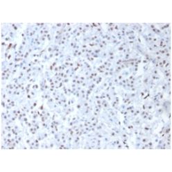 Wilm's Tumor 1 (WT1) (Wilm's Tumor & Mesothelial Marker), Biotin conjugate, 0.1mg/mL