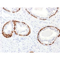 p63 (Squamous, Basal &amp; Myoepithelial Cell Marker), Biotin conjugate, 0.1mg/mL