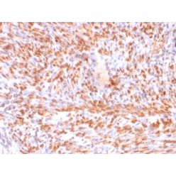 Calponin-1 (Smooth Muscle Marker) (rCNN1/832), Biotin conjugate, 0.1mg/mL