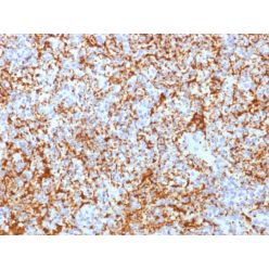 CD61 / Integrin 3 / Platelet Glycoprotein IIIa (Platelet Marker)(ITGB3/2166R), Biotin conjugate, 0.1mg/mL