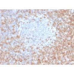 CD5 (Mantle Cell Lymphoma Marker) (CD5/2416), Biotin conjugate, 0.1mg/mL