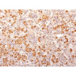 ACTH (Adrenocorticotrophic Hormone)(57), 0.2mg/mL