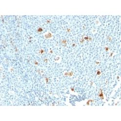 Calprotectin (MRP14)(S100A9)(CPT/1028), 0.2mg/mL