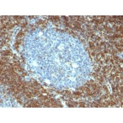 bcl-2(BCL2/796), 1mg/mL