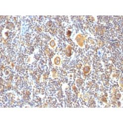 bcl-6(BCL6/850), 1mg/mL