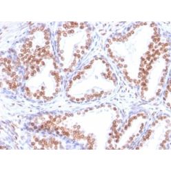 Androgen Receptor(DHTR/882), 1mg/mL