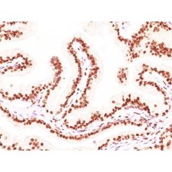 Androgen Receptor(AR441 + DHTR/882), 1mg/mL